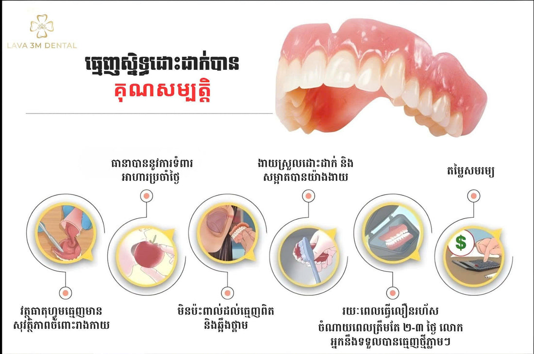 គុណសម្បត្តិនៃធ្មេញស្និតដោះដាក់