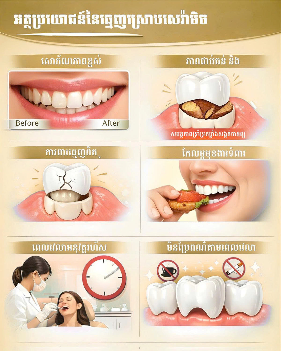 តើការធ្វើធ្មេញសេរ៉ាមិច (Porcelain Crowns) ល្អដែរឬទេ?