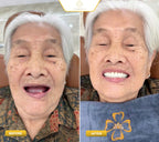 ធ្មេញស្និតប្រភេទសេរ៉ាមិច