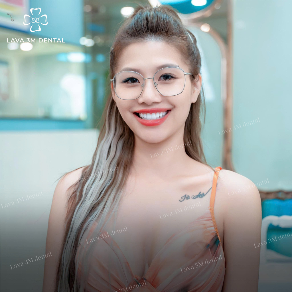 ធ្មេញសេរ៉ាមិច Orodent
