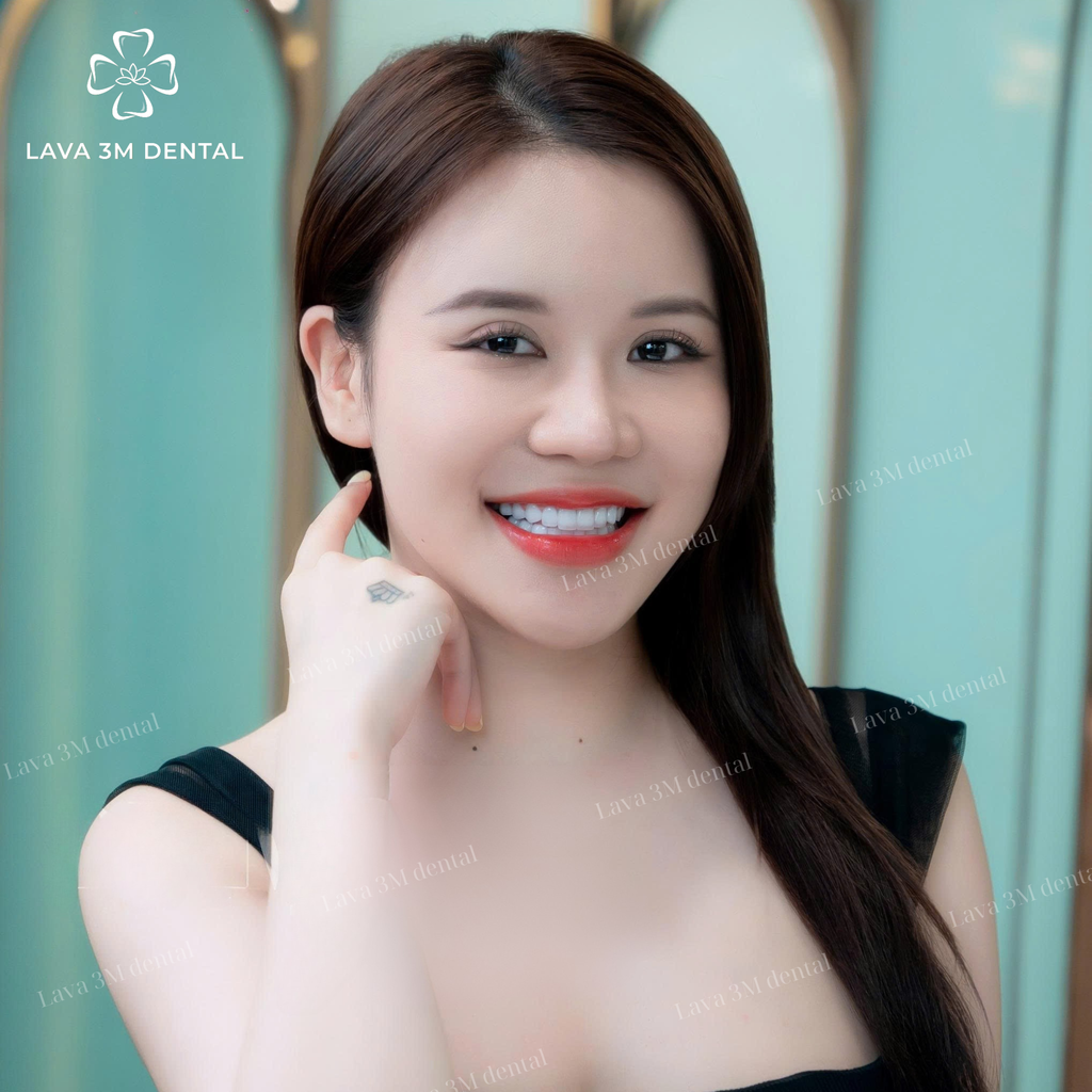 ធ្មេញសេរ៉ាមិច Zirconia
