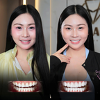 ធ្មេញសេរ៉ាមិច Orodent