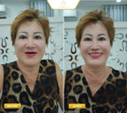 ធ្មេញស្និតដោះដាក់ប្រភេទ Composite