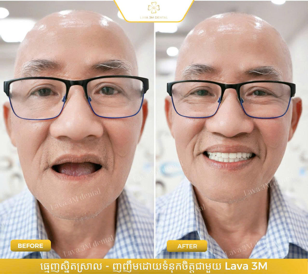 ធ្មេញជ័រដោះដាក់បាន