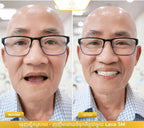 ធ្មេញជ័រដោះដាក់បាន